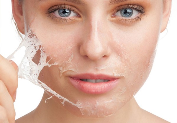 Cara Mengatasi Kulit Wajah yang Mengelupas Karena Kering