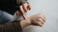 Tips Merawat Kulit Kering Bersisik agar Kembali Mulus